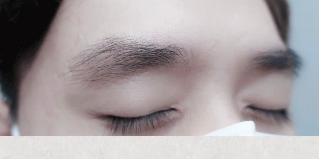 남자 눈썹 시술 전